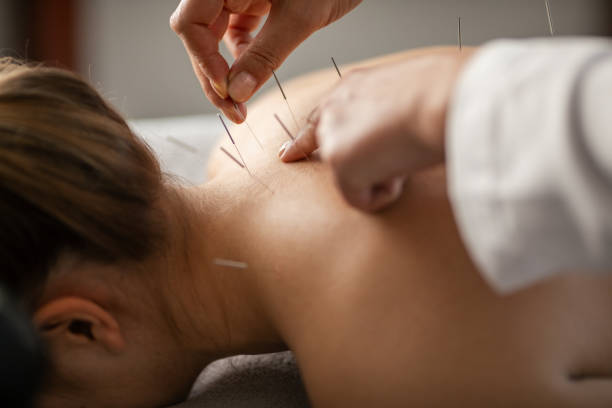 Acupuncture treatment